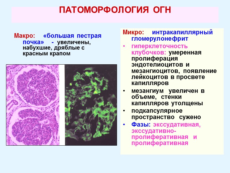 ПАТОМОРФОЛОГИЯ ОГН  Макро:    «большая пестрая почка»    -